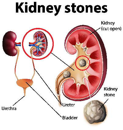 Kidney